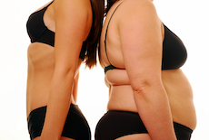 多汗症と肥満の関係